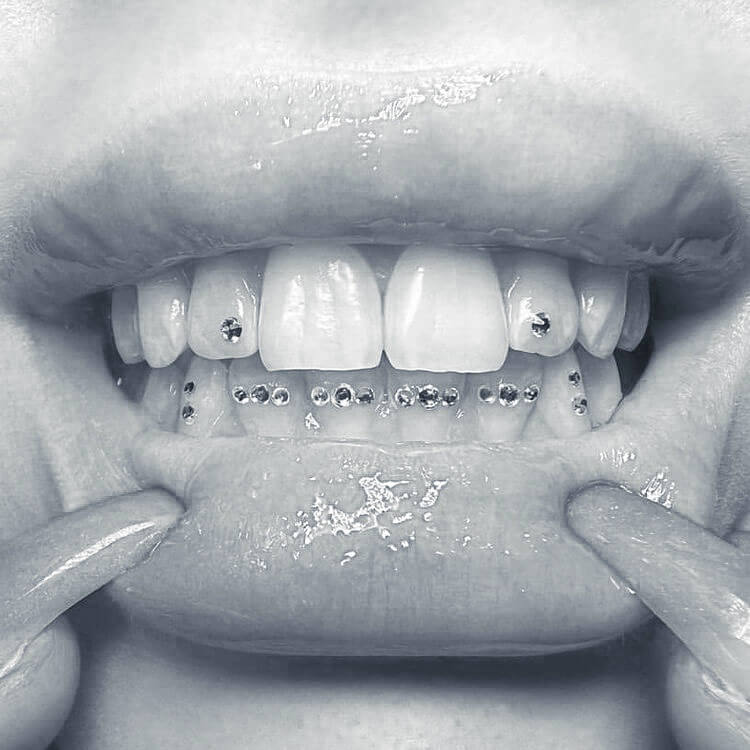 adorned tooth gems teeth