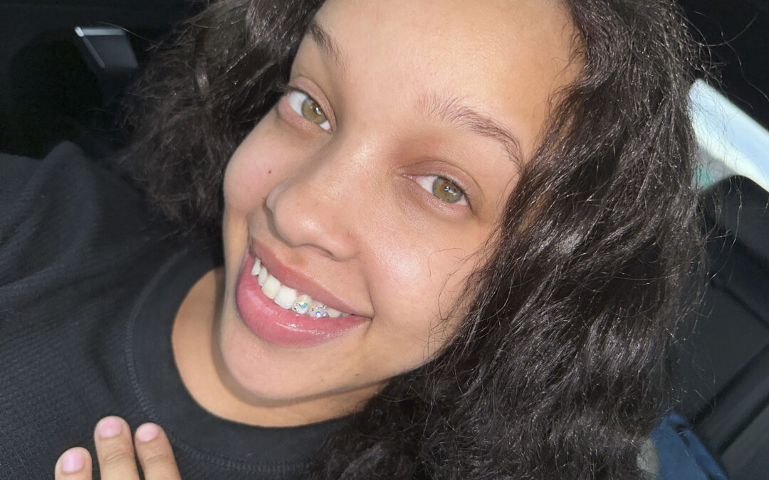 Who’s a Good Candidate for Tooth Gems? (And Who Isn’t)